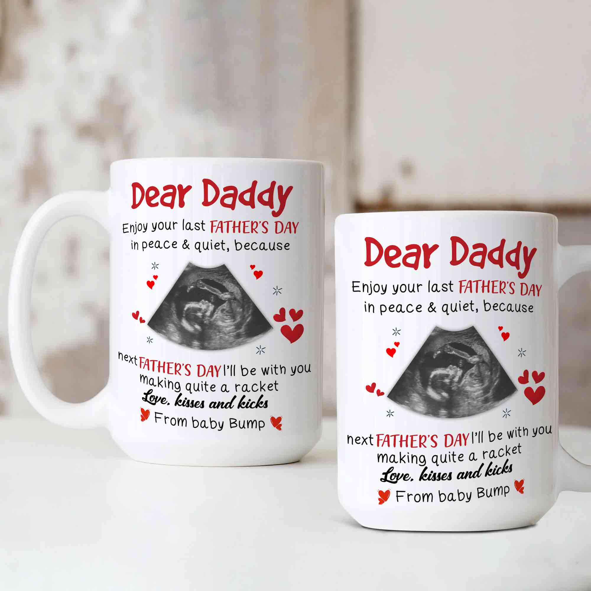 Personalized Baby Ultrasound Dad Mug, Dad Coffee Mug, Pregnancy Reveal, Gift For Dad From Baby, First Father's Day, Father To Be Gift